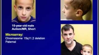 Genetics of Autism From Chromosomes to Mitochondria.flv