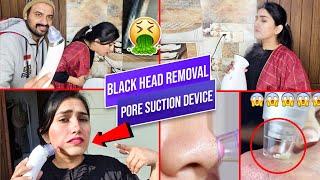 Black Head Removal pore Cleaner Device | blackhead  pore vacuum | Does it Work???