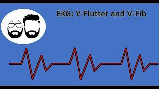 EKG Series: Ventricular Flutter (V-Flutter) and Ventricular Fibrillation (V-Fib)