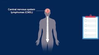 Profiling Circulating Tumor DNA to Monitor and Classify Brain Lymphomas