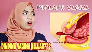 PROLAPS V4GIN4/TURUN PERANAKAN??? SIMAK VIDEO INI