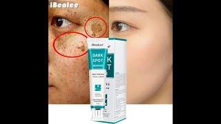 Whitening Freckle Cream Remove Melasma, Dark Spot – iBeaLee™