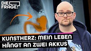 Warten auf ein Wunder: Ich lebe mit einem Herz in der Tasche! | Muss ich meine Organe spenden?