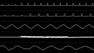 Naoki Kodaka - "Batman (NES) - Boss Theme" [Oscilloscope View]