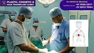 Phimosis Treatment | Zsr Circumcision Surgery In India , Circumcision Surgery Cost