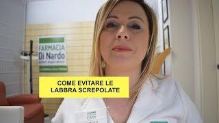 Labbra screpolate: 3 segreti per evitarle