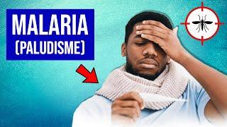 Malaria (Paludisme) : Symptômes et Traitements