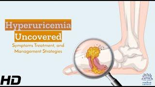 Hyperuricemia: Understanding Its Signs, Effects & Management Essentials