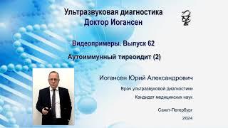 Ультразвуковая диагностика. Доктор Иогансен. Видеопримеры. Выпуск 62. Аутоиммунный тиреоидит (2).