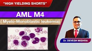 High Yielding Shorts-31 (#HYS-31) : AML M4 ( Myelo-Monoblastic leukemia) by Devesh Mishra.