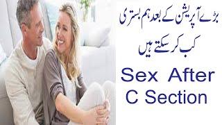 sex after c section / when can you have sex after c section / when to have sex after c section