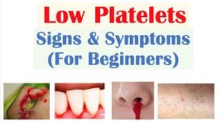 Low Platelets: Signs & Symptoms (Basics for Beginners)