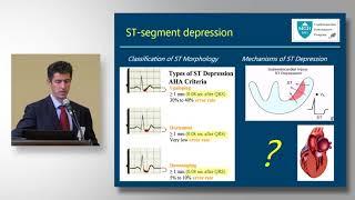 Aaron Baggish, MD, Pathologic T Wave Inversion and ST Segment Depression