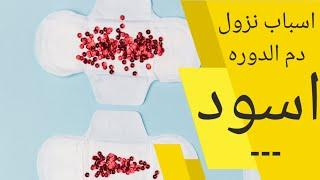 دم الدورة اسود؟ | ما سبب نزول دم اسود في بداية الدورة الشهرية | الدم الاسود في الدورة الشهرية