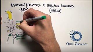 Estrogen Receptors &  HER2/neu Receptors in Breast Cancer (a TUTORIAL from Oster Oncology)