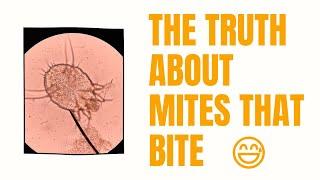 The Truth About Mites that Bite: With Examples