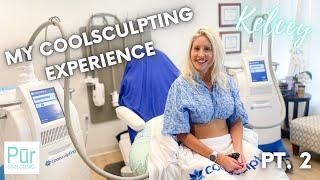 MY COOLSCULPTING EXPERIENCE PT. 2 | Flanks Treatment | Pūr Skin Clinic