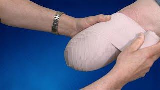 Wrapping Technique BK Residual Limb | Springer Prosthetic & Orthotics Services