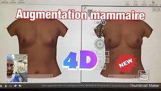 AUGMENTATION MAMMAIRE NATURELLEMENT TECHNIQUE 3D 4D À PARIS