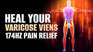 Heal Your Varicose Veins | Enhance Proper Blood Flow In Arms Hands & Legs | 174 Hz Pain Relief