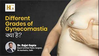 Different Grade of Gynecomastia को कैसे Identify करते हैं? पुरुष स्तन के 4 प्रकार | Dr Rajat Gupta