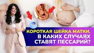 КОРОТКАЯ ШЕЙКА МАТКИ. ⭕В каких случаях ставят пессарий? I Укорочение шейки матки