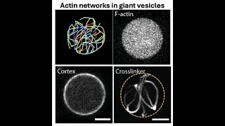 Allen Liu: Building synthetic cells with a cytoskeleton