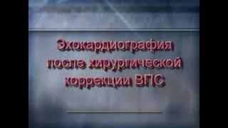 Эхо- Кг в оценке хирургической коррекции ВПС. Часть 1.