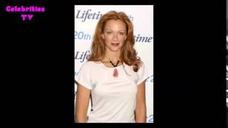 Lauren Holly Plastic Surgery Before and After