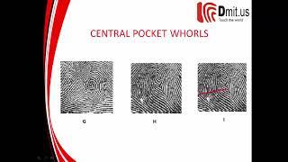 [DMIT Software] DMIT सॉफ्टवेयर | Unit 4 - Characteristics of fingerprints Whorls  pattern,