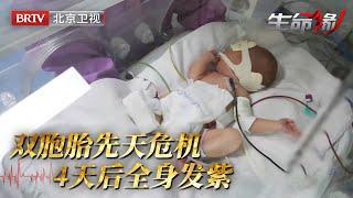 孕妇怀上双胞胎却双双危机，胎儿罹患心脏病紧急转运北京，不想4天后全身发紫，心脏全部堵死……【生命缘第14季】