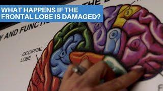 What Happens If The Frontal Lobe Is Damaged?