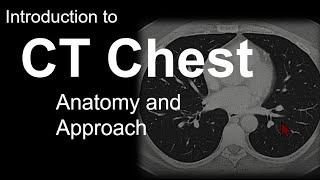 Introduction to CT Chest - Anatomy and Approach