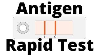 How SARS-CoV2 Antigen Rapid Tests work (Covid-19 Testing)