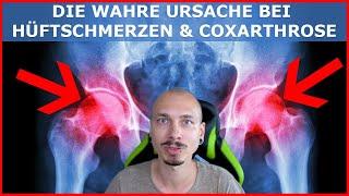 Die WAHRE Ursache bei Hüftschmerzen und Hüftarthrose (Coxarthrose)