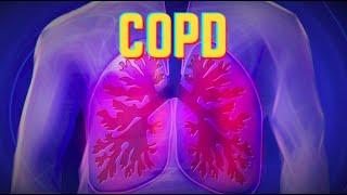 COPD (updated 2023) - CRASH! Medical Review Series