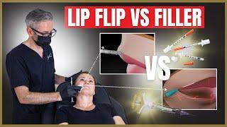 Lip Flip vs Dermal Filler | What is Lip Flip?