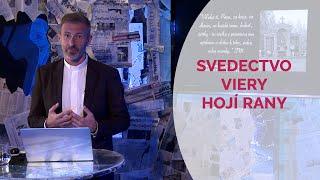 SVEDECTVO VIERY HOJÍ RANY | vKONTEXTE