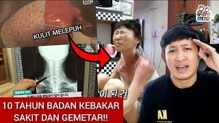 PENEMUAN BENDA SUPER ANEH DALAM TUBUH WANITA TUA YANG TERIAK KESAKITAN!! TERNYATA...