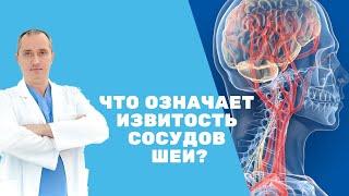 Что означает извитость сосудов шеи?