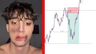 Trader Breaks Even So He BREAKS HIS FACE (Trade Recap)