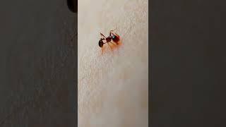 Fire ant bite and Sting