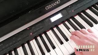 Electronic Keyboard Instruments | Key Velocity Issues | Keys Silent or Too Loud