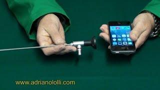 IPhone ADATTATORE diretto VIDEO FOTO per ENDOSCOPIO BOROSCOPIO LAPAROSCOPE