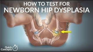 How to Test for Newborn Hip Dysplasia by N. Gold | OPENPediatrics