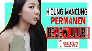 REVIEW HASIL OPERASI PLASTIK (IMPLANT HIDUNG) DAN TREATMENT KECANTIKAN TERBAIK DI JAKARTA UTARA