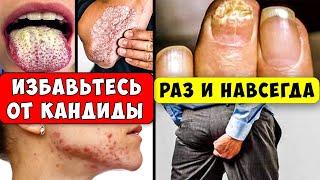 Ешьте Эти 10 продуктов и Кандидоз никогда не вернется! Супер-еда от Грибка...