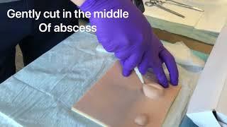 Abscess Incision & Drainage
