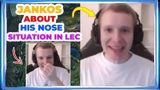 Jankos About His NOSE Situation in LEC 