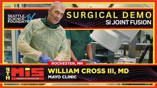 SI Joint Fusion - William Cross, M.D.